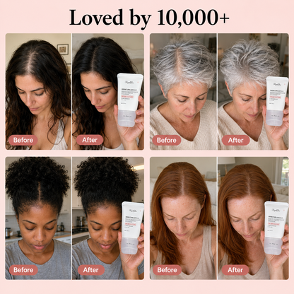 RoyalGlow Grow:Turn Ampoule – Scalp Care Serum for Hair Growth